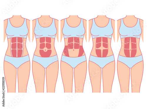 Female Abdominal Muscle Types Illustration - Various Rectus Abdominis Shapes and Core Anatomy Variations for Fitness and Healthcare