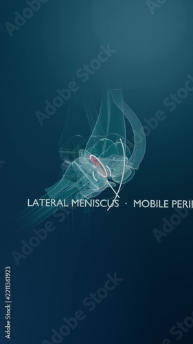 Vertical video: Starting animation 3D knee tilting to side on teal showing red meniscus white arc