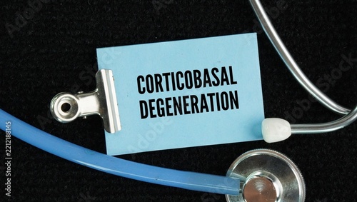Obraz na plátně Stethoscope and paper with the words Corticobasal degeneration CBD is a rare, pr