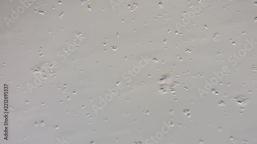 Microscopic view of bacteria causing sore throat and seasonal illness, medical microbiology lab research 