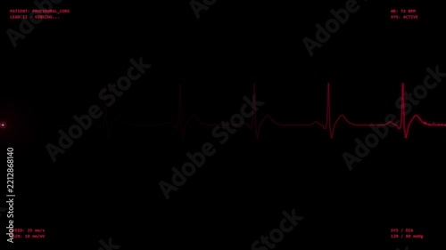 Heart rate monitor medical screen showing rhythmic ecg wave progression in dark environment.