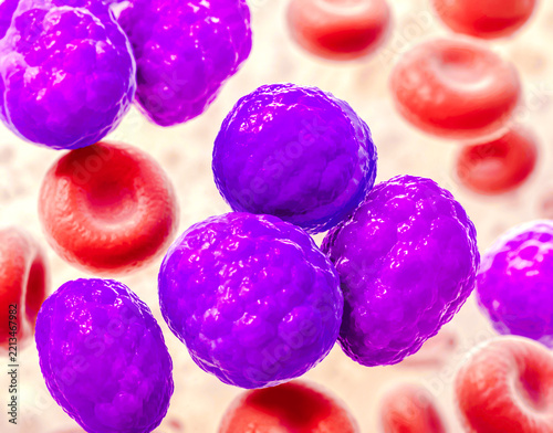 Acute myeloid leukemia (AML) is a type of blood cancer. Microscopic examination of blasts or leukemia cells in blood smear of human. 3D Illustration