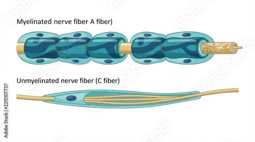 Myelinated nerve fiber A type and unmyelinated nerve fiber C type in peripheral nerve anatomy.