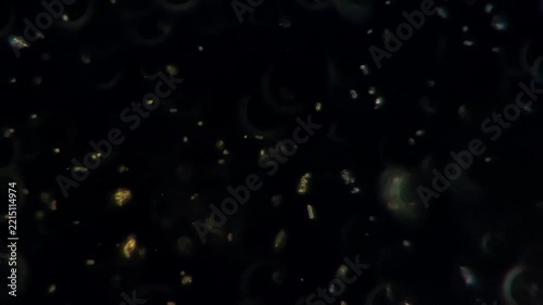 Gut microbiota probiotics under darkfield microscope - Lactic acid bacteria and yeast in fermented milk kefir 