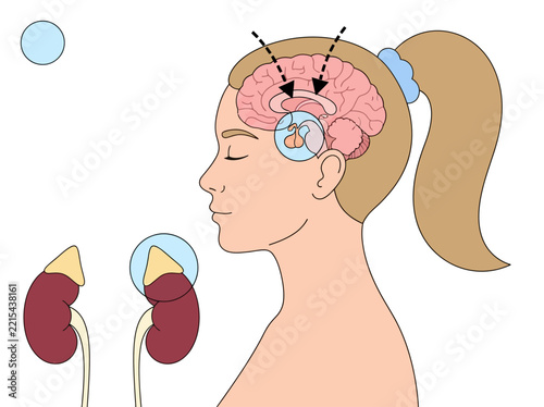 Medical Illustration of the HPA Axis Stress Response Connecting the Brain Pituitary Gland and Adrenal Glands in a Woman