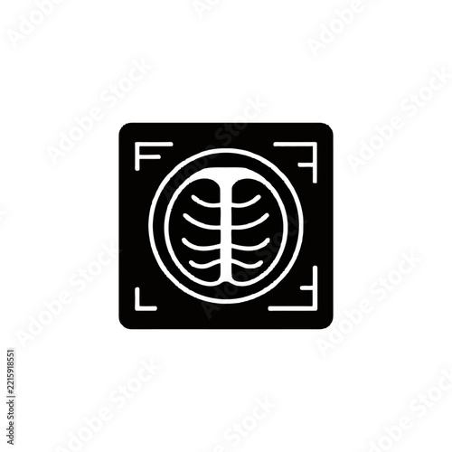 Medical X-ray Image of Chest Showing Rib Cage.