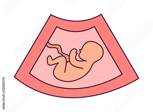 Colorful ultrasound scan showing unborn baby fetus in womb