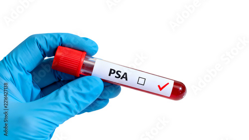 Hand in blue glove holding a blood test tube labeled psa, isolated on transparent background