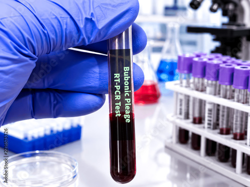 Blood sample for Bubonic plague (RT-PCR) test. It's one of three types of plague caused by the bacterium Yersinia pestis. 3D Illustrator