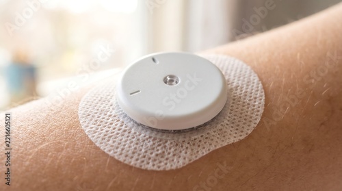 Close-up of a white continuous glucose monitor sensor with a sterile adhesive patch applied firmly to human skin for modern diabetic blood sugar management.