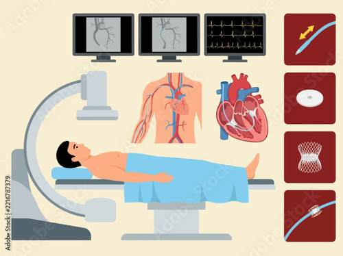 Medical Illustration of Cardiac Catheterization Procedure, Heart Anatomy, and Stent Placement in a Hospital Operating Room with X-ray Equipment