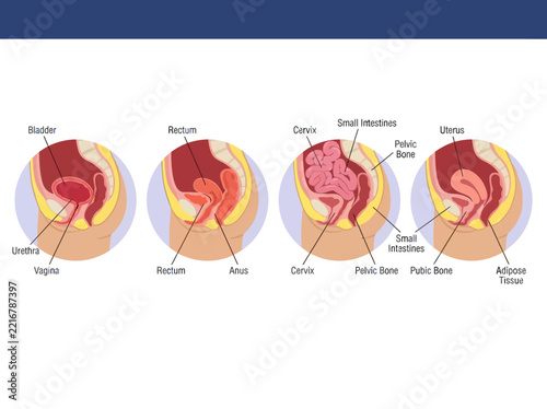Female Pelvic Anatomy Illustration Set Showing Reproductive, Urinary, and Digestive Systems with Uterus, Bladder, Rectum, and Cervix Labels for Medical Education