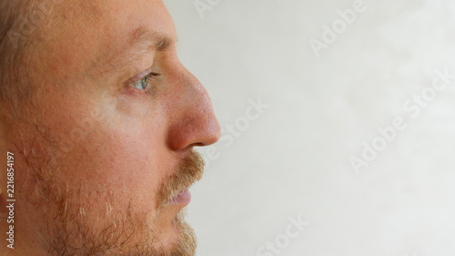 Close up side profile view of man with aquiline nose before rhinoplasty surgery