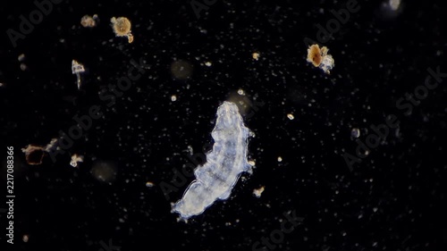Tardigrade Under Microscope Close-Up View of Water Bear Moving in Dark Field Microscopic Sample