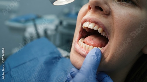 A young woman opens her mouth wide in a dental examination. A dentist is examining her oral cavity, pointing to an area of concern.