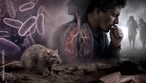 Pneumonic plague infection.