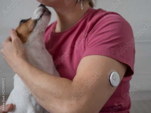 A woman with a continuous glucose monitor on her arm is hugging a dog.