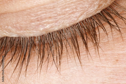 Closed eyelid