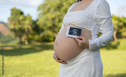 Expectant mother holding an ultrasound image beside her baby bump outdoors in a sunny park