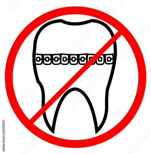 No Braces Allowed Sign with Red Prohibition Symbol, Dental Orthodontic Icon