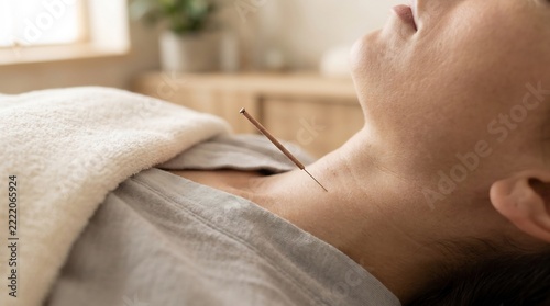 acupuncture needle on neck for alternative therapy and pain relief