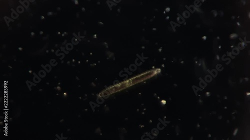 Microscope View of a Single Pennate Diatom Alga Moving in Darkfield Illumination