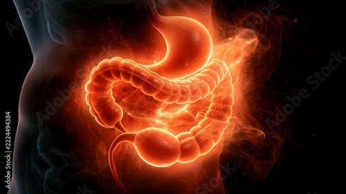 Heartburn causes and effects on your body
