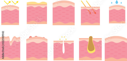Collection of skin anatomy cross section illustrations isolated on white background, vector of skin layers, uv protection, hydration, pores, acne, and dermatology clipart