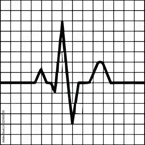 Black and white line art illustration of an ECG heartbeat waveform on a grid chart, for cardiology, healthcare and medical education
