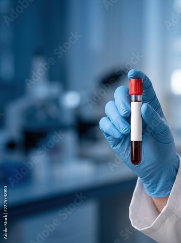 Blood sample in a test tube held by a gloved hand in a laboratory.
