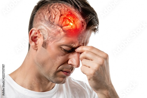 Man Experiencing Severe Headache With Inflamed Brain Highlight and Painful Forehead, Human Neurology Medical Illustration Isolated on White Background