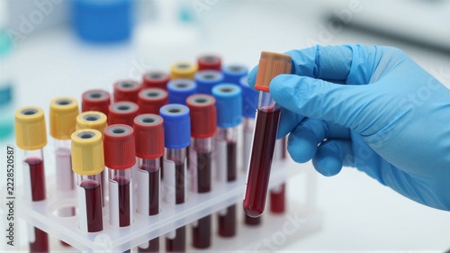 Gloved hand holding blood sample tube with orange cap above rack of capped blood vials in clinical laboratory setting, shallow depth of field