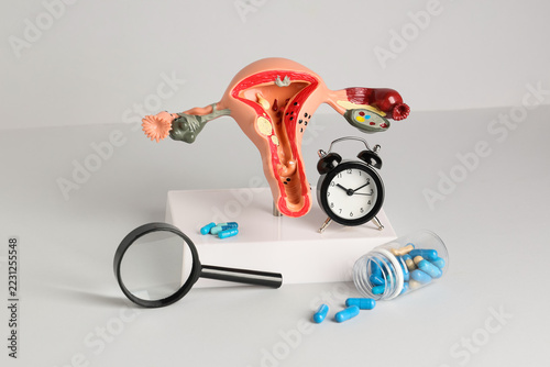 Obraz na plátně Reproductive health and fertility treatment, anatomical uterus model with alarm