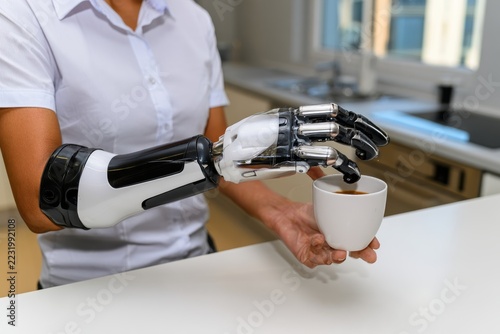 Woman uses myoelectric forearm prosthesis to pick up a coffee cup in her kitchen